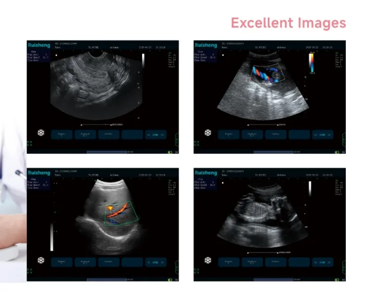 Ultrasound Scanner Machine 4