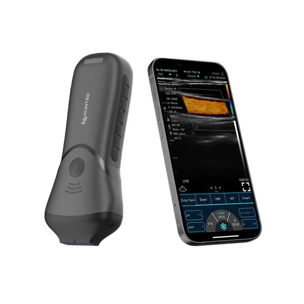 China Manufacturing Portable Pocket Ultrasound System For Mobile Cardiac Health Assessments