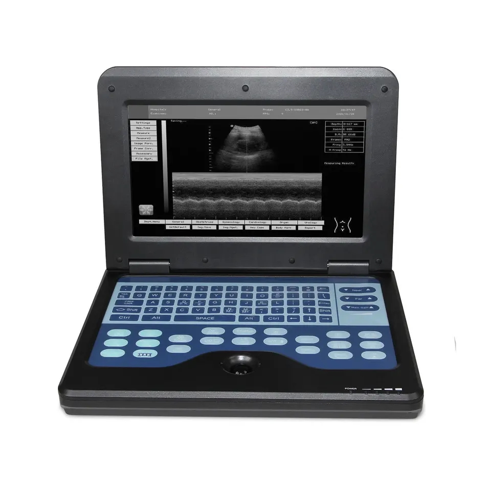 Medco Good Quality Medical Device Scanner Machine Handheld Ultrasound Diagnostic System