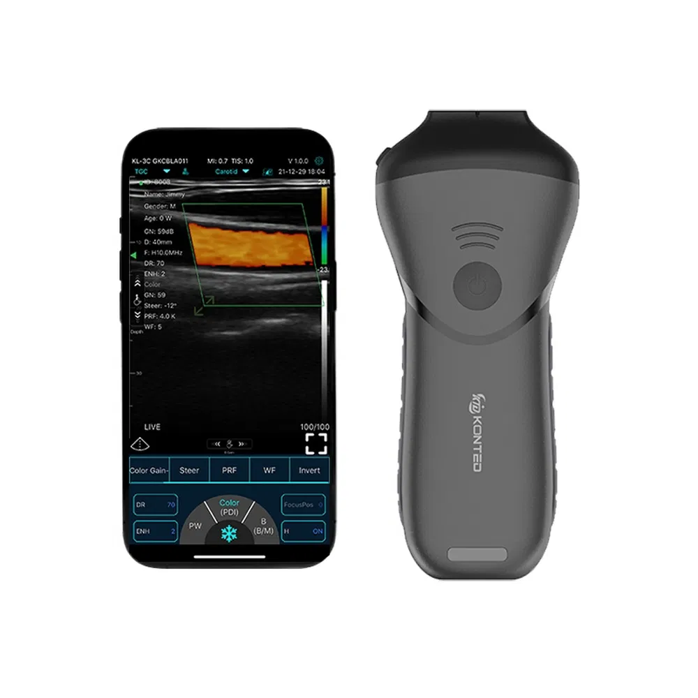 China Manufacturing Portable Pocket Ultrasound System For Mobile Cardiac Health Assessments