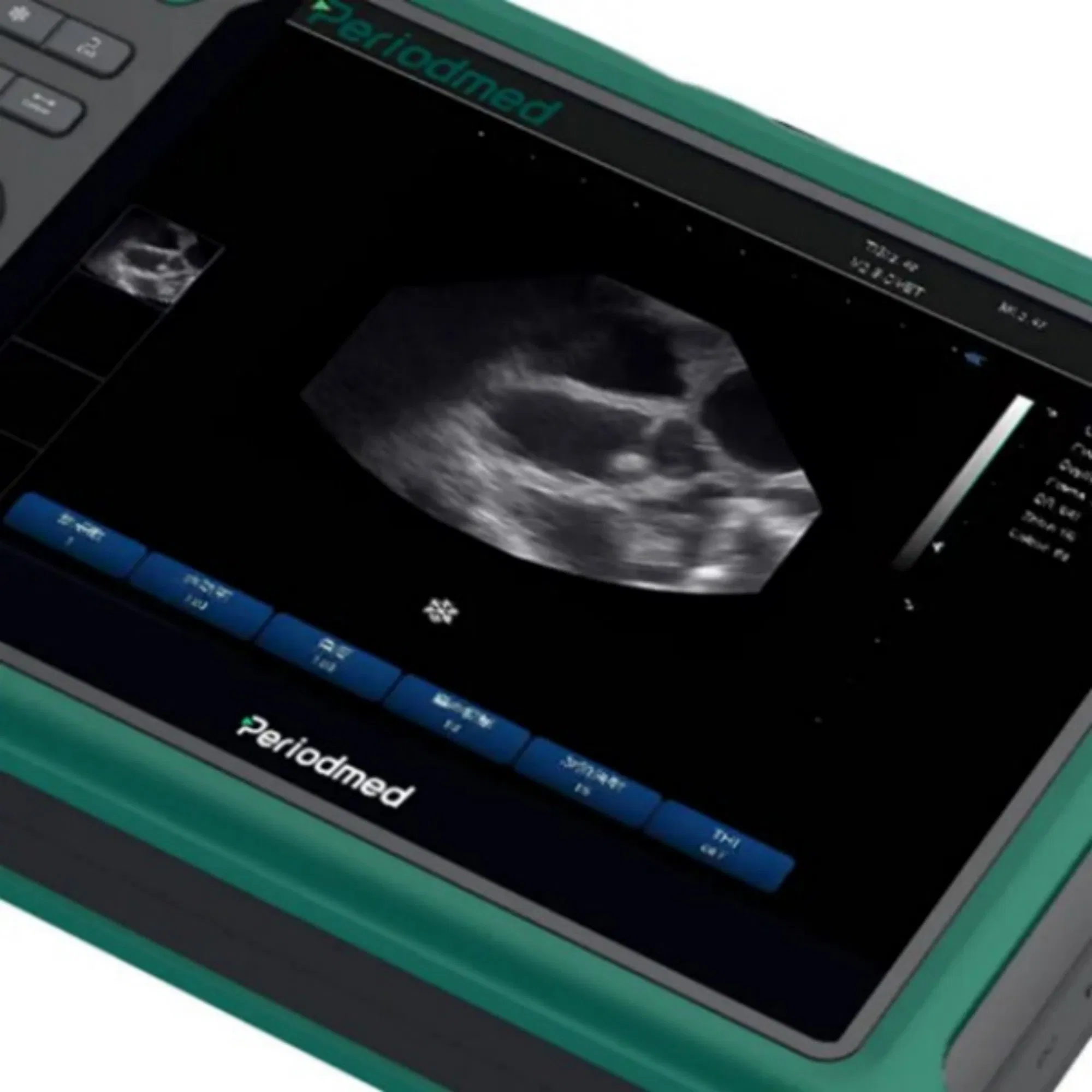 Advanced Periodmed Veterinary Ultrasound System Health Diagnostics