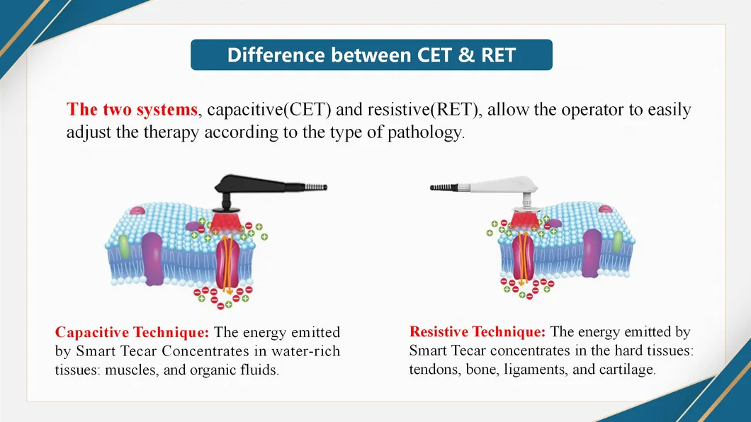 CET and RET