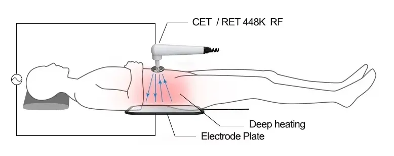 Technology Mechanism