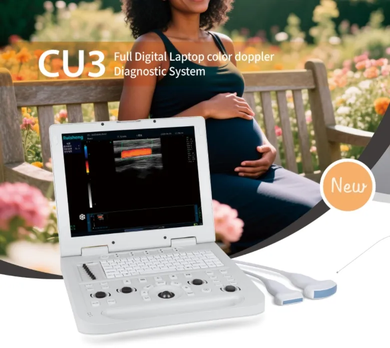 Ultrasound System Display 1