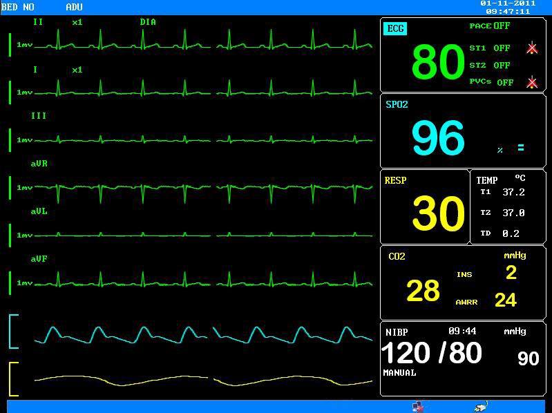 12.1 Inch Color TFT Display Pdj-3000 Patient Monitor