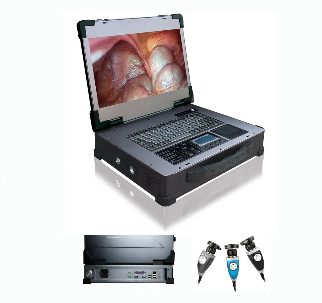 Endoscope Camera 2