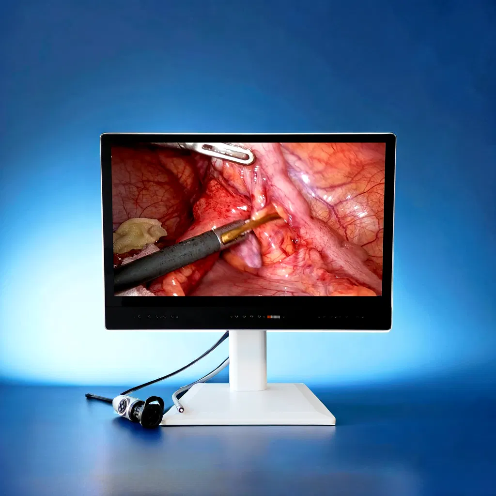 24inch Endoscope Camera System with Medical Grade Monitor