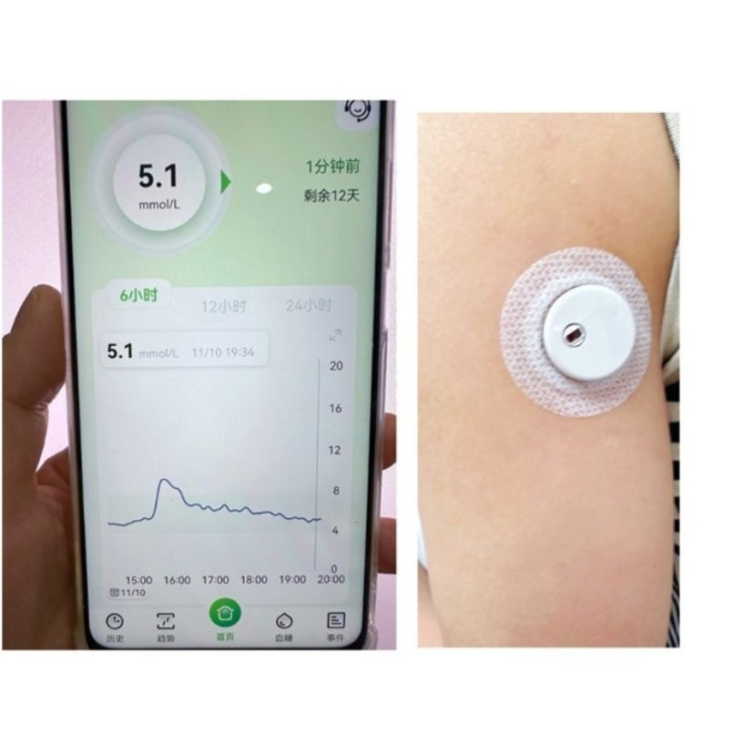 Dispositivo portátil médico continuo en tiempo real no invasivo inteligente de monitoreo digital de glucosa