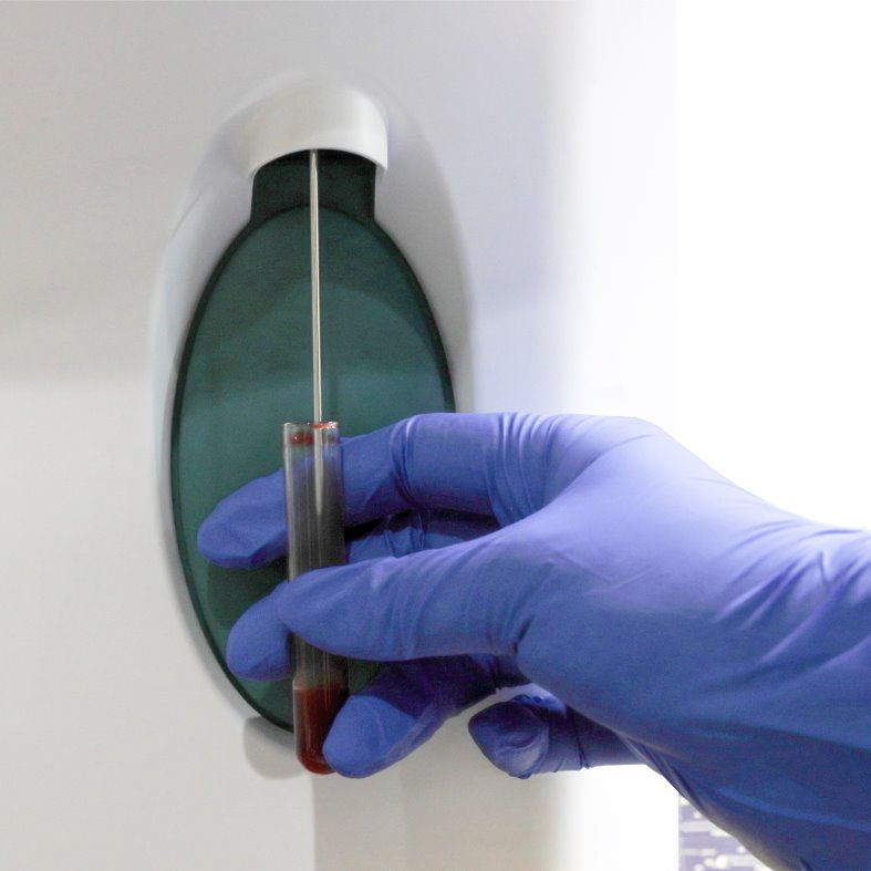 Analizador de hematología de alta calidad y durabilidad con sistema de apertura automática variado