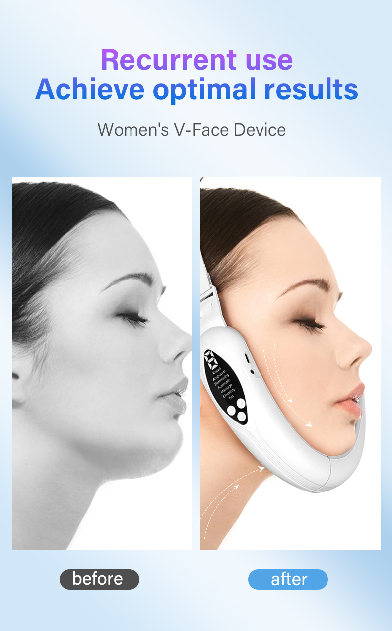 V Face Beauty Device Detail 3