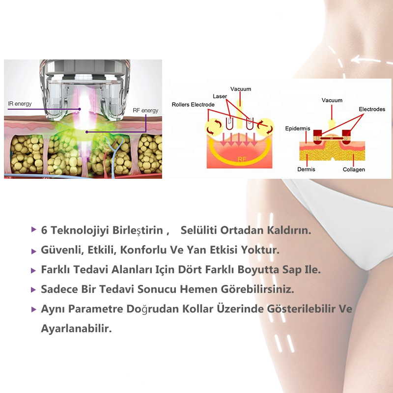 5 In1 Body Sculpt Slimming Shaping Vela RF Roller Vacuum Ultrasound Cavitation Shape Weight Fat Loss Beauty Machine