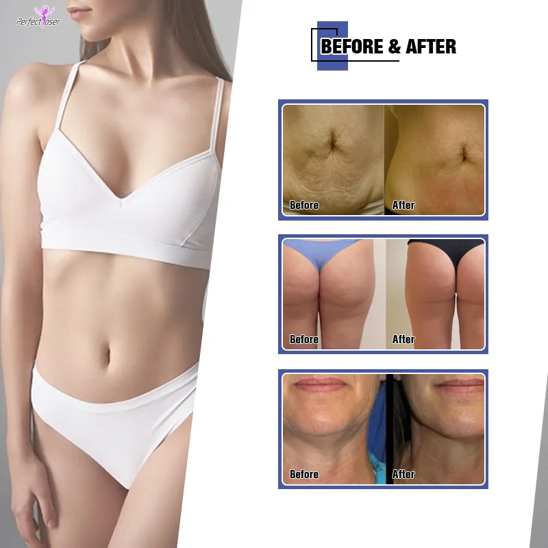 5in1 Body Sculpt Beauty Machine Image 9