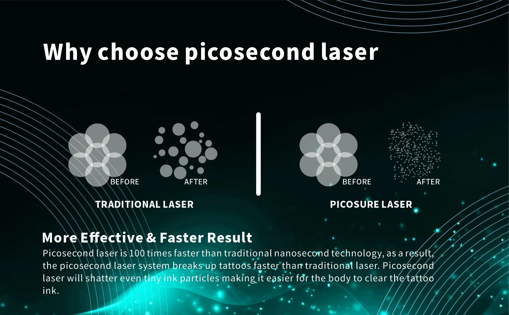 CE Approved Picosecond Laser Machine for Tattoo Removal and Skin Rejuvenation