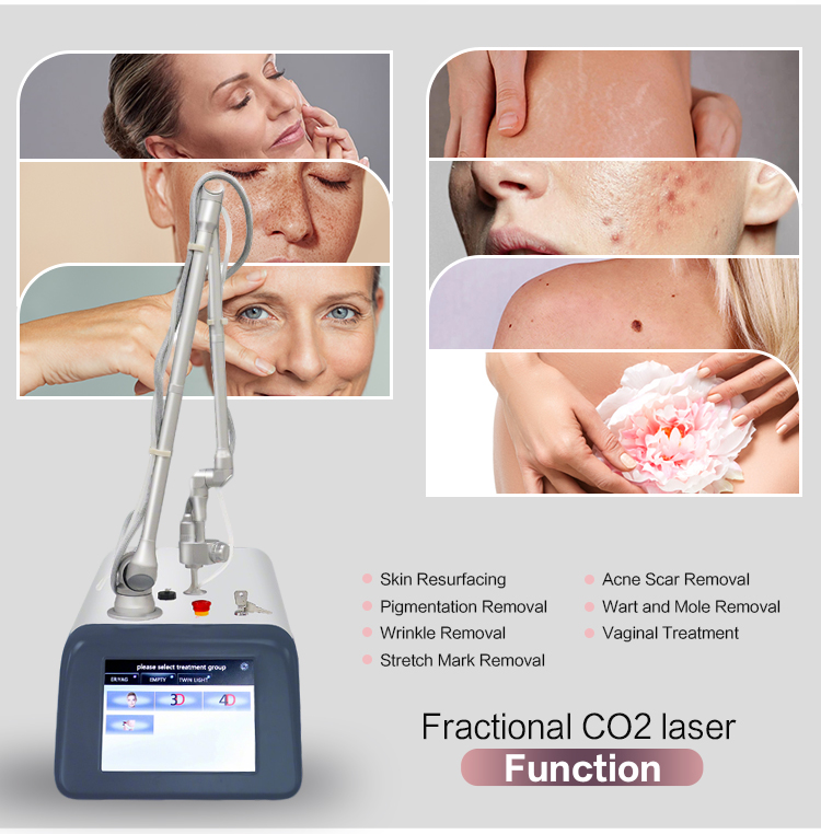 Treatment Head 1