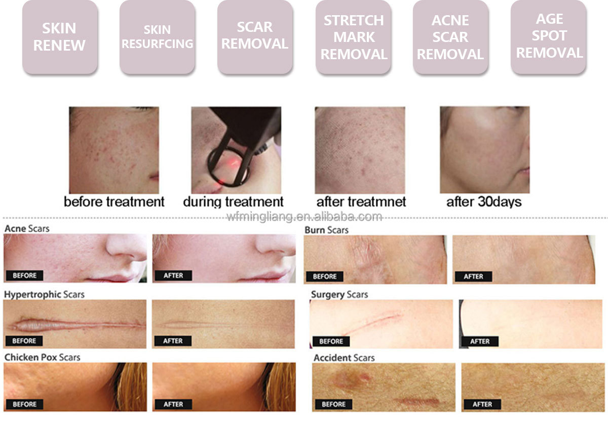Treatment Detail