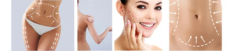 5 In1 Body Sculpt Slimming Shaping Vela RF Roller Vacuum Ultrasound Cavitation Shape Weight Fat Loss Beauty Machine