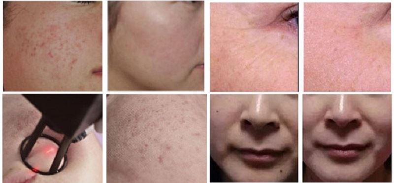 Before and After Results
