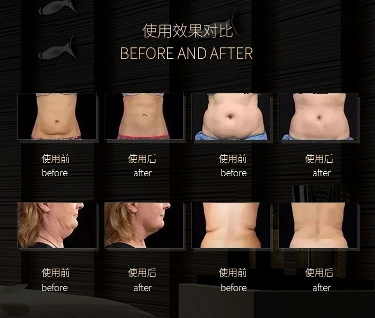 5 in 1beauty Salon Ultrasonic 40K RF Cellulite Reduce RF Ultrasound 40K Cavitation Machine Fat Burning Body Shaping Machineno Reviews Yet