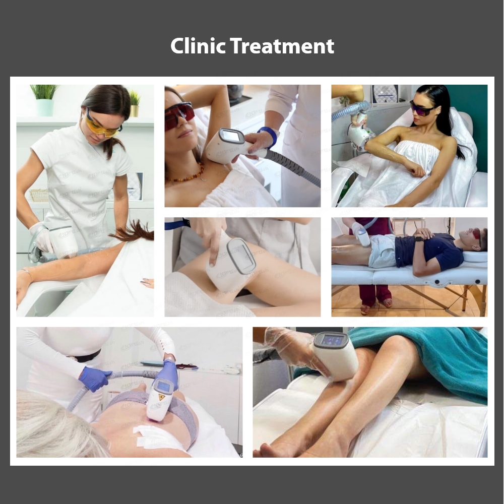 All Colour Skin Type Dioden Laser Laser Diodo Hair Removal Machine 808nm