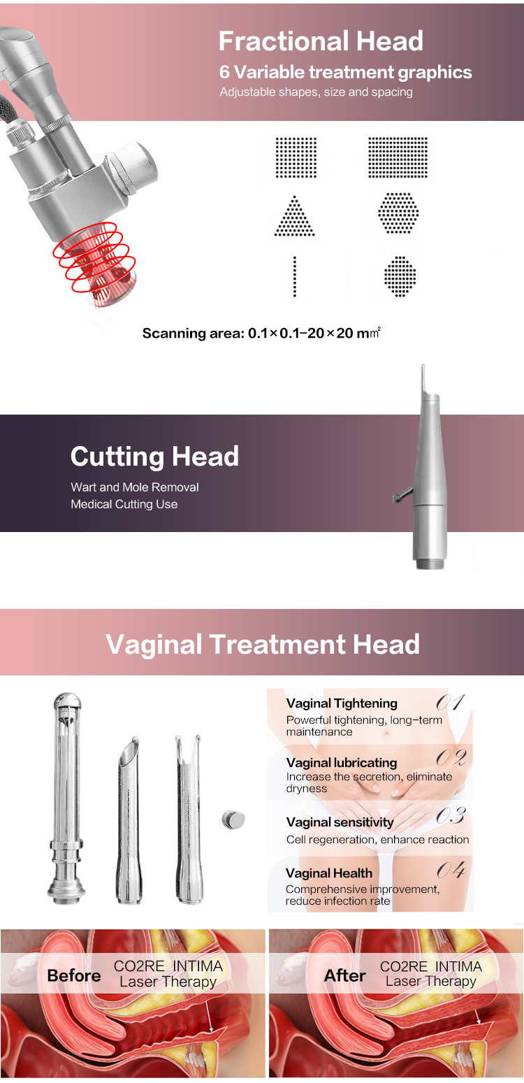 Treatment Head 3