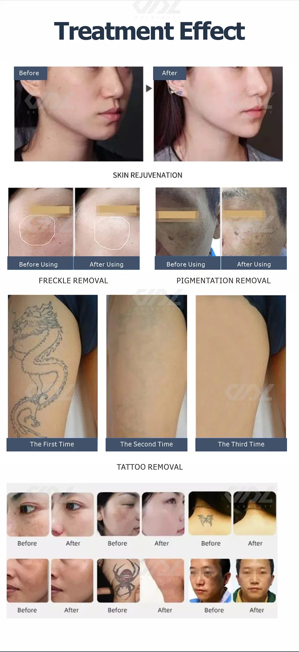 Picosecond Laser Tattoo Removal Machine Display 7