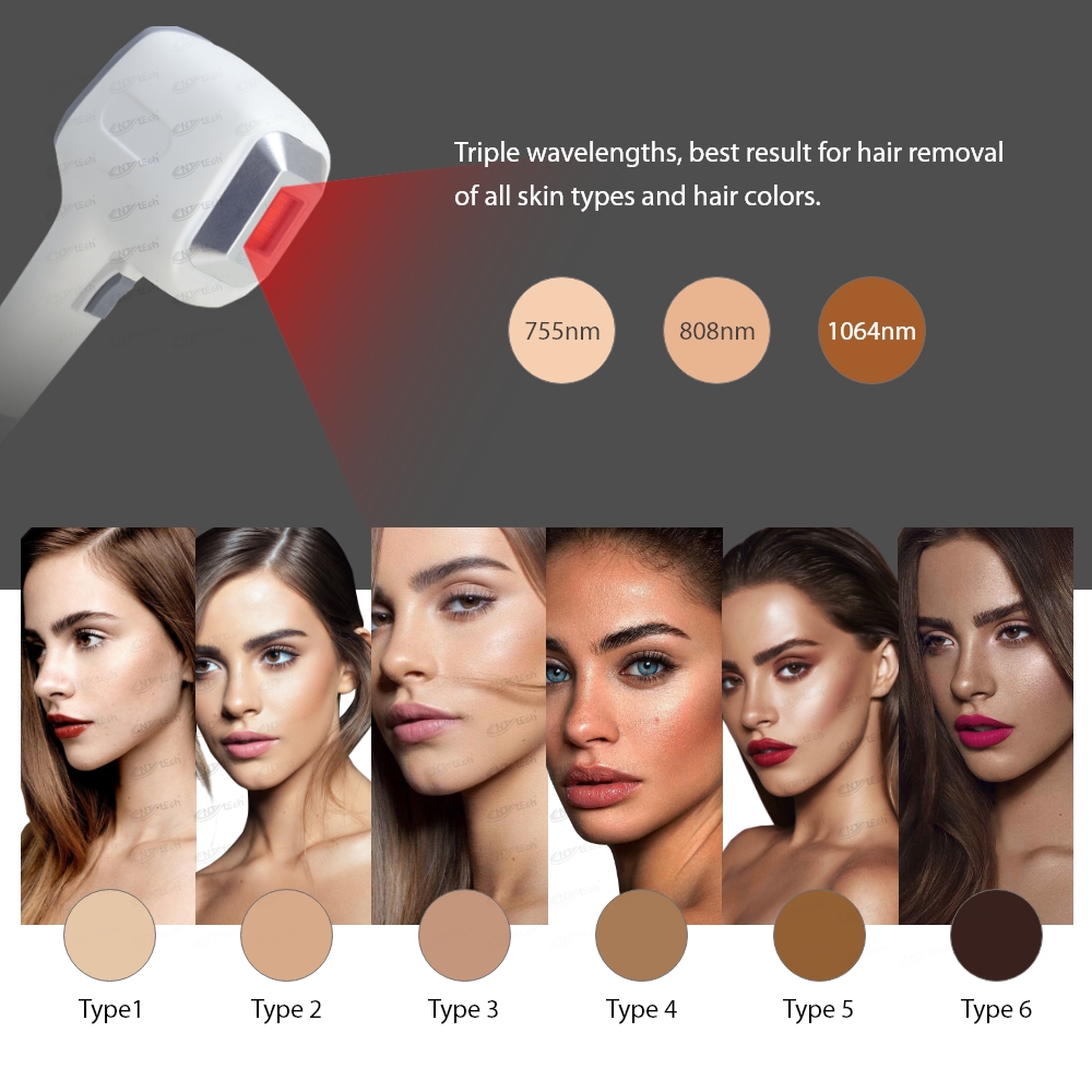 All Colour Skin Type Dioden Laser Laser Diodo Hair Removal Machine 808nm