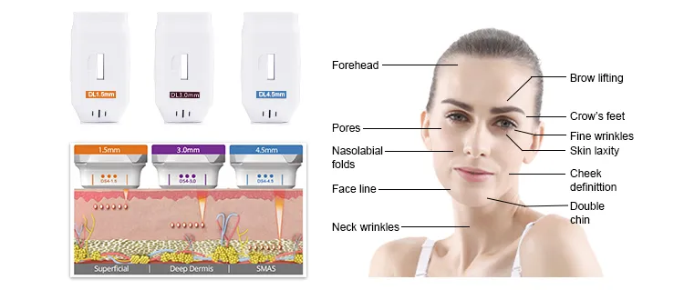 Face Lifting