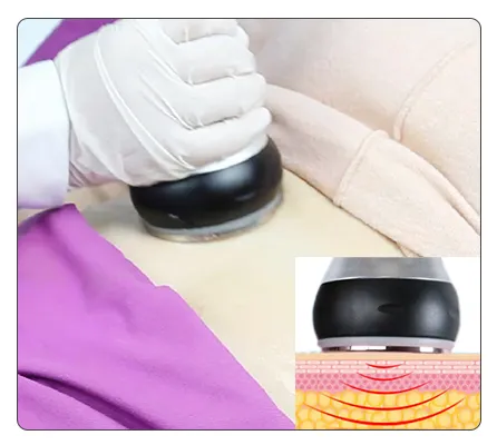 40KHz Cavitation Principle