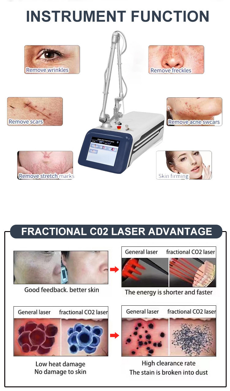 Product View 1
