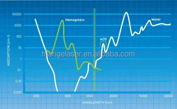 1470nm Laser Performance