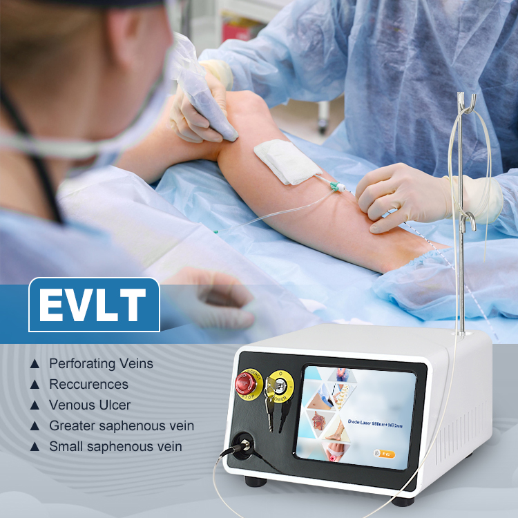 Medical Equipment Surgical Evlt Laser Endovascular 980nm 1470nm Radial Fiber
