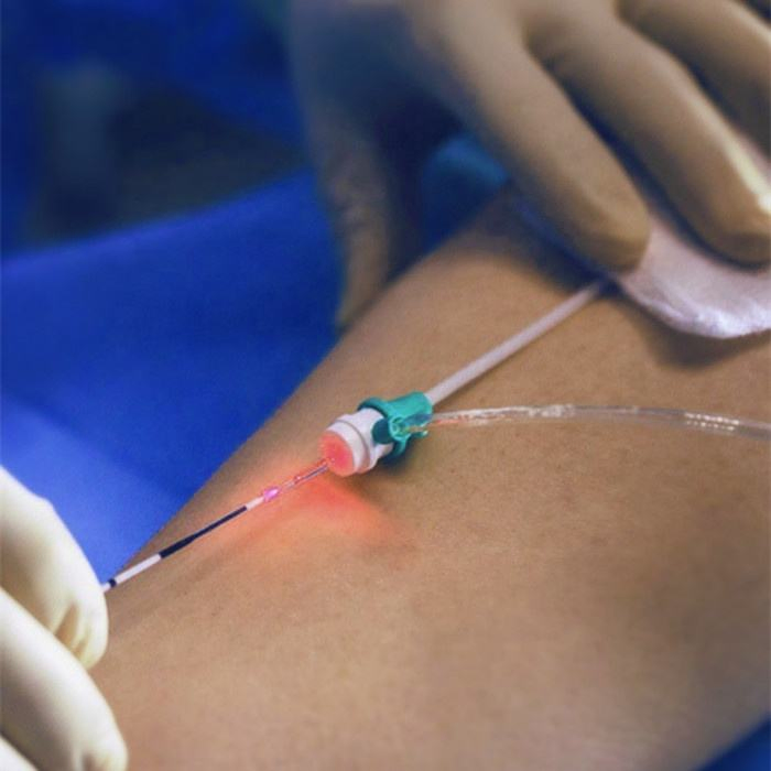 Real Power Single 1470nm 20W Medical Diode Laser Leg Vein Varicose Spider Vein Removal Evlt Treatment Device