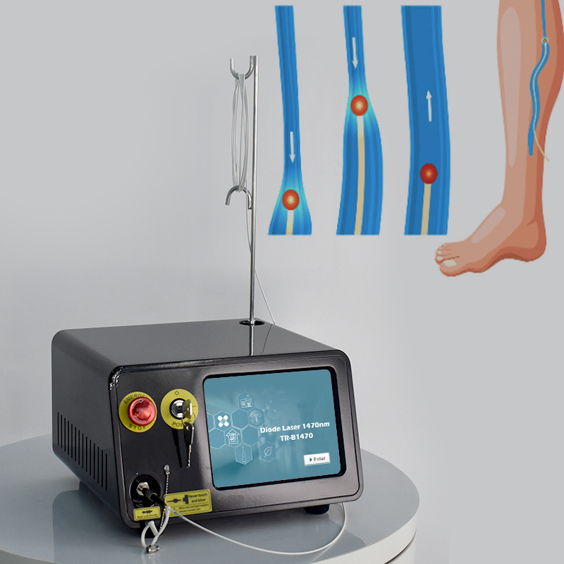 980nm Evlt Treatment Device Vascular Laser Diode Evla Diode Laser 1470nm