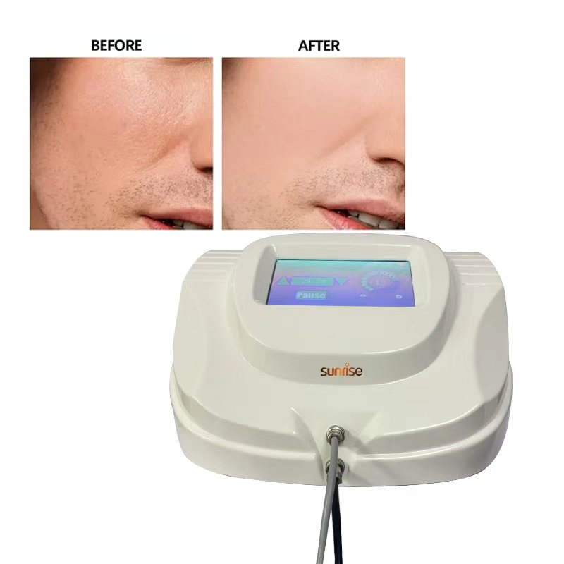 2025 Cost-Effective Electrolysis Rbs Permanent Hair Removal Electrolysis Machine for Sale