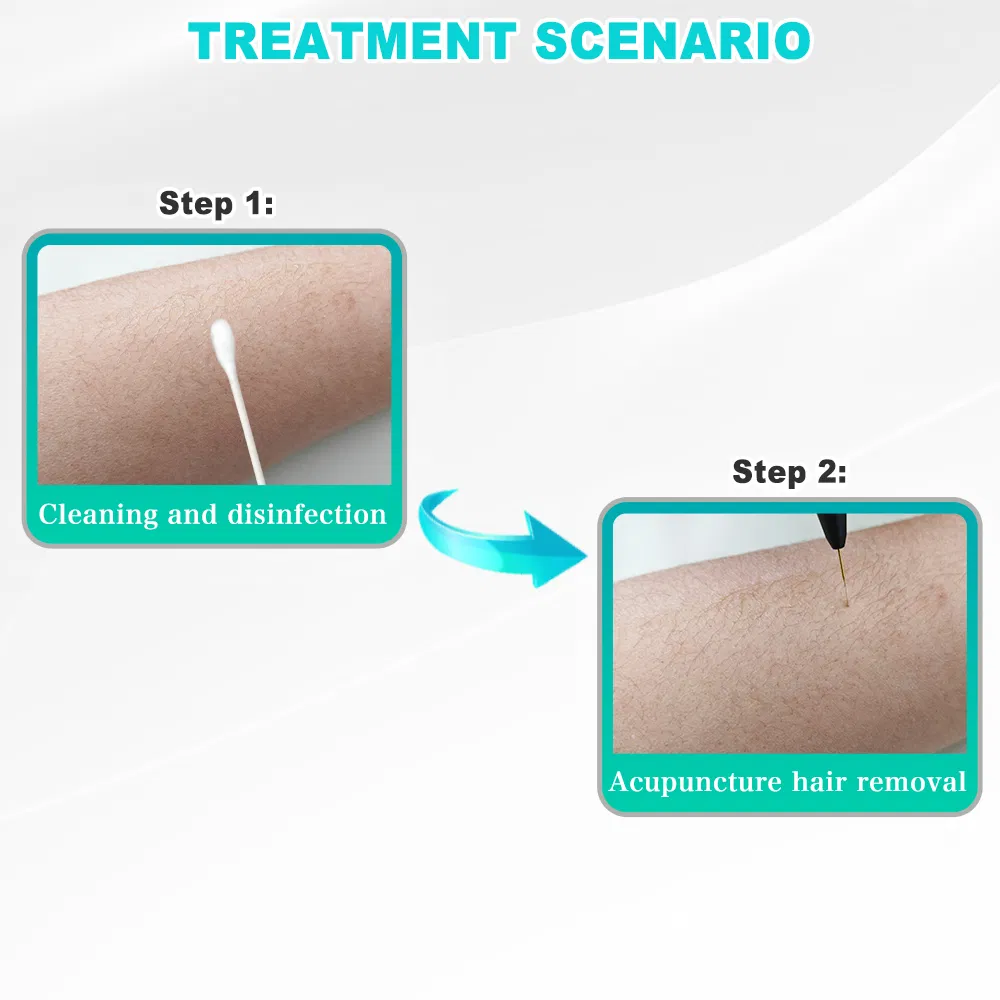 Agent Price Hair Remover Fast Blend Electrolysis Hair Removal Machine with Gold Needle*10 for Body and Face