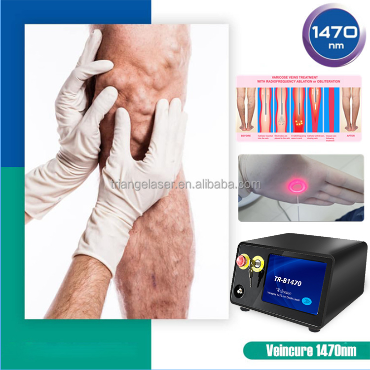 980nm Evlt Treatment Device Vascular Laser Diode Evla Diode Laser 1470nm