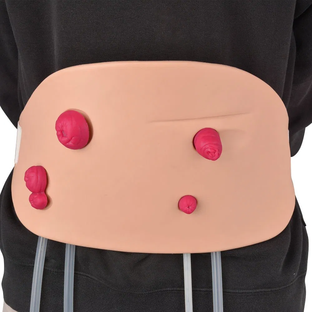 Wearable Stoma Care Model, Ostomy Procedure Training Kit Simulation System