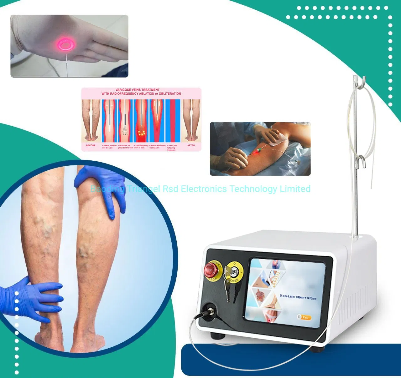 1470nm/980nm Evlt Varicose Vein Diode Laser Fiber 6 in 1 Multi-Function Machine
