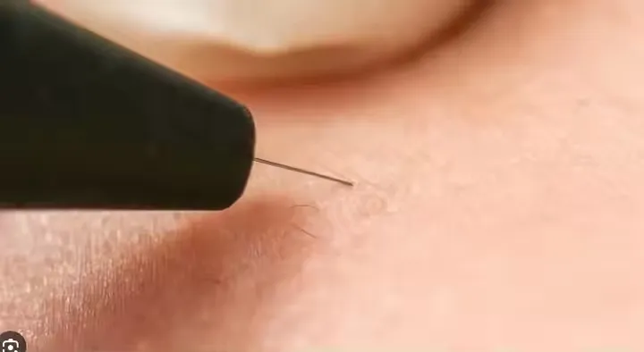 Treatment Comparison