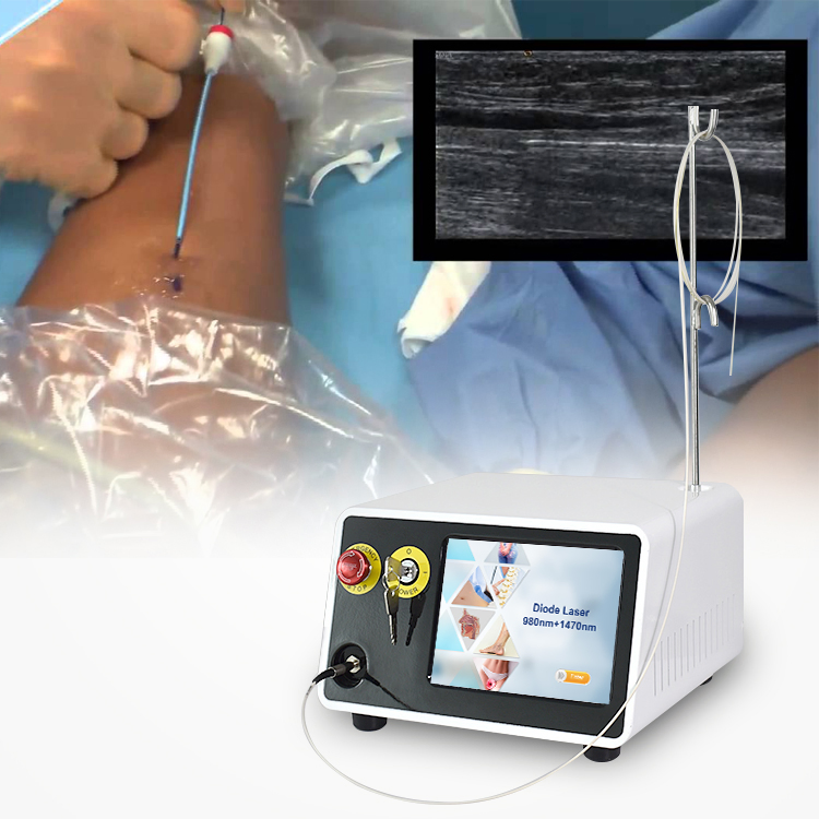 1470nm/980nm Evlt Varicose Vein Diode Laser Fiber 6 in 1 Multi-Function Machine