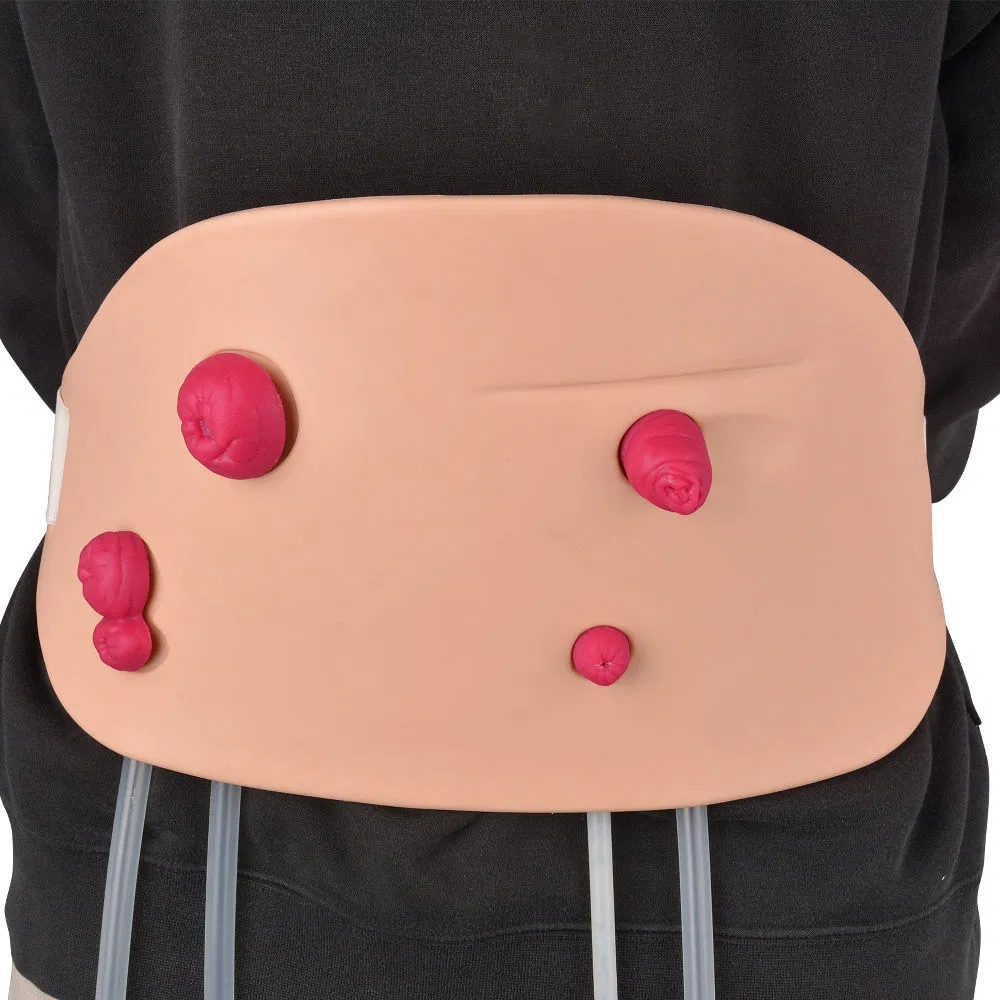 Stoma Care Model 2