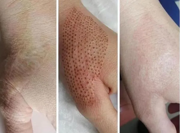 Before and After Results