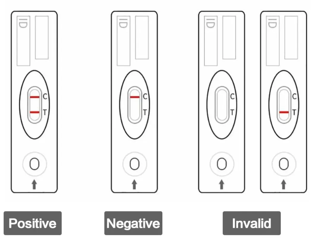 Test Result Interpretation