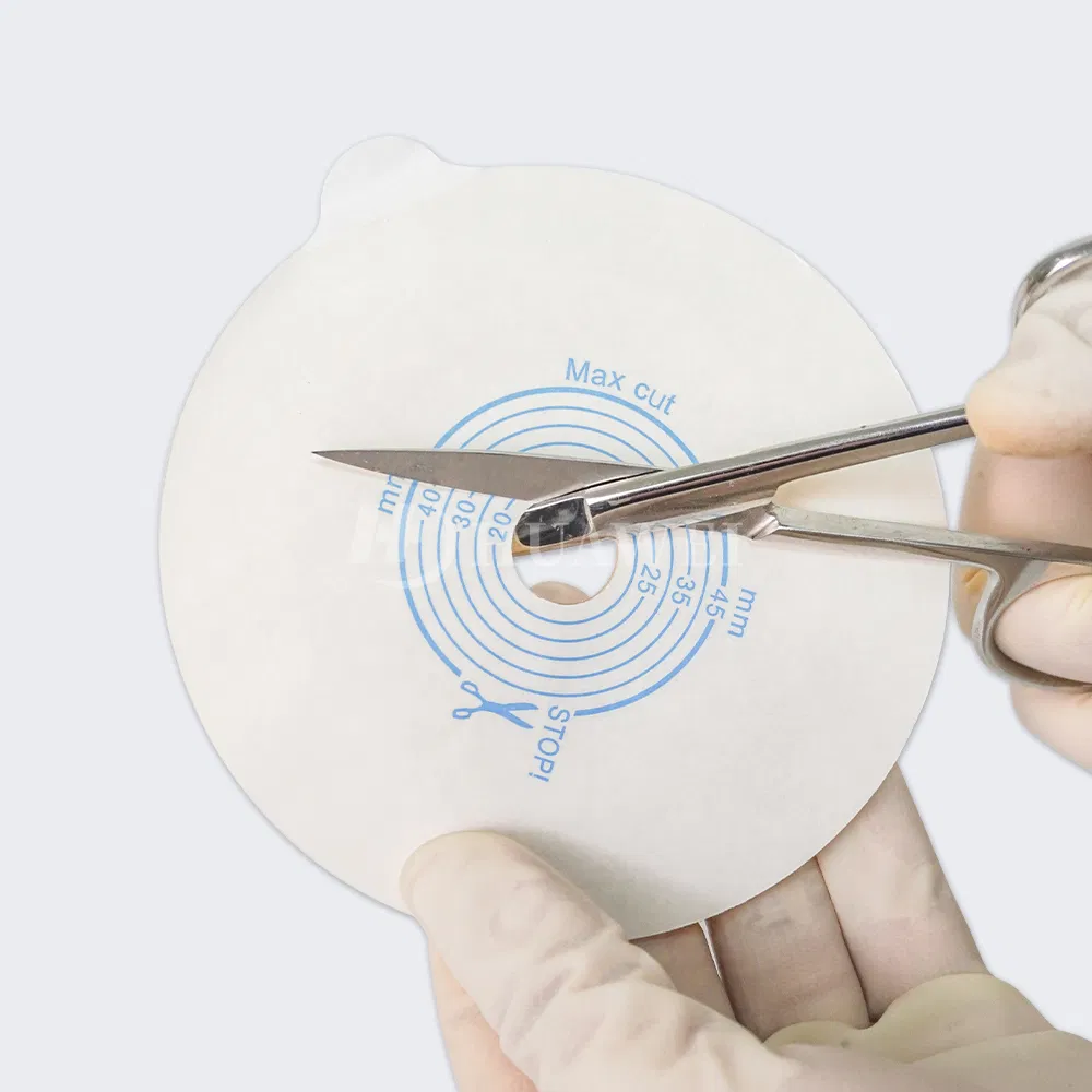 Ostomy Bag Accessories OEM Manufacturer Custom Stoma Care Parts Factory Direct Supply