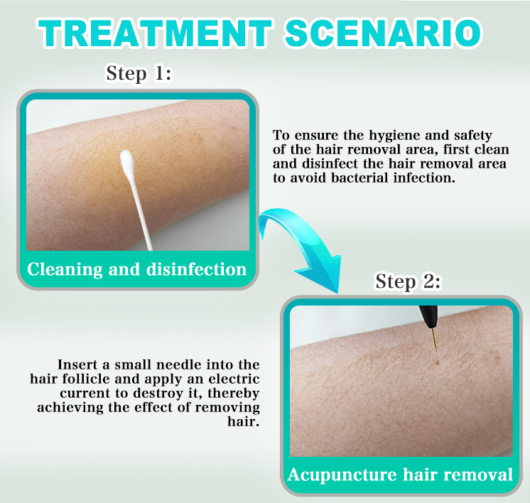 Portable Blend Electrolysis Needle White Hair Removal Machine for Facial and Body