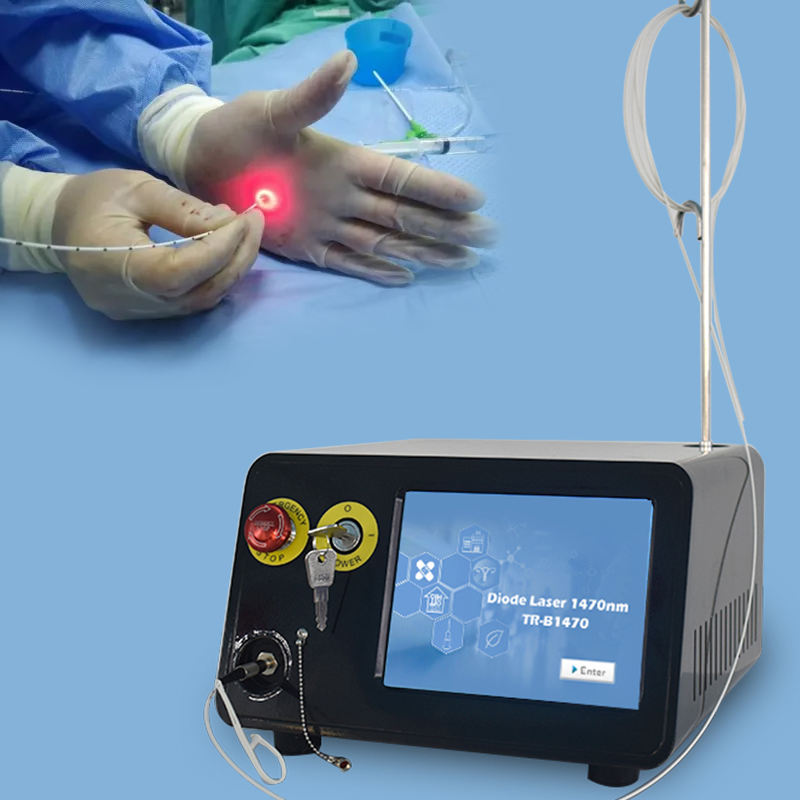 980nm Evlt Treatment Device Vascular Laser Diode Evla Diode Laser 1470nm