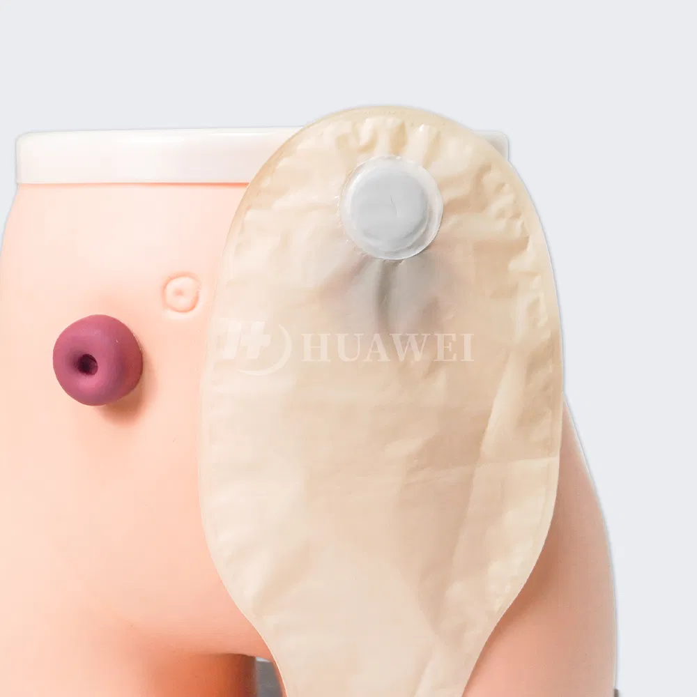 Ostomy Bag Accessories OEM Manufacturer Custom Stoma Care Parts Factory Direct Supply