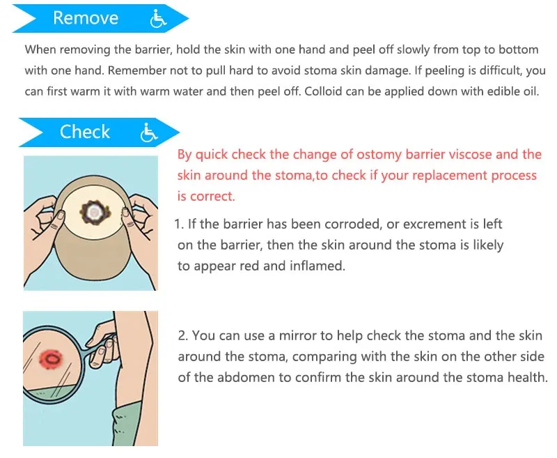 Ostomy Bag Feature 4