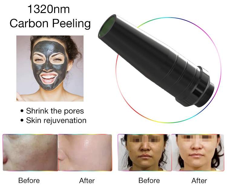 Professional Picosecond Laser 532nm/755nm Tattoo Removal Acne Treatment Skin Rejuvenation Commercial Use Machine