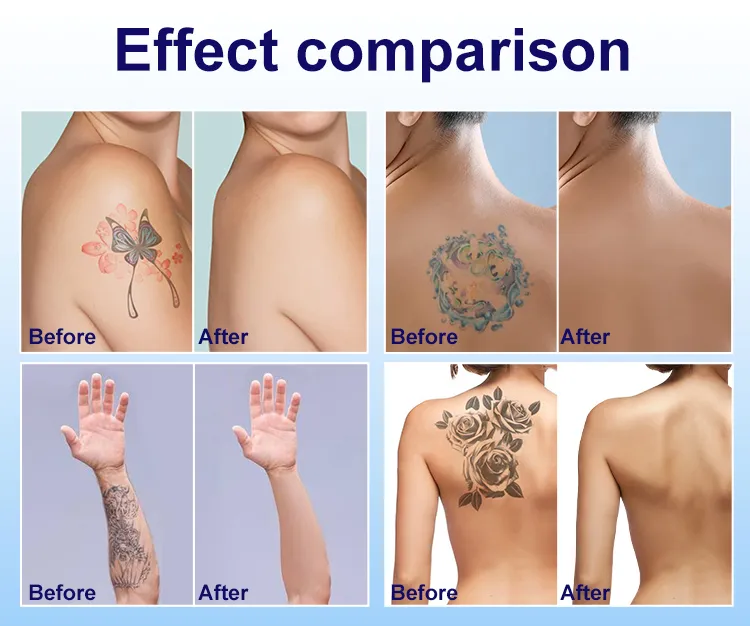 Treatment Result 3